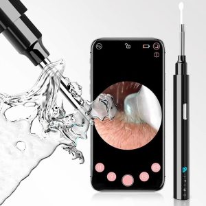 Personal Care | 1080P Ear Wax Removal Otoscopes 360 Degree Wide Angle Visual Earwax Removal Camera Ear Cleaner Wireless Otoscope – Black Health & Beauty Black